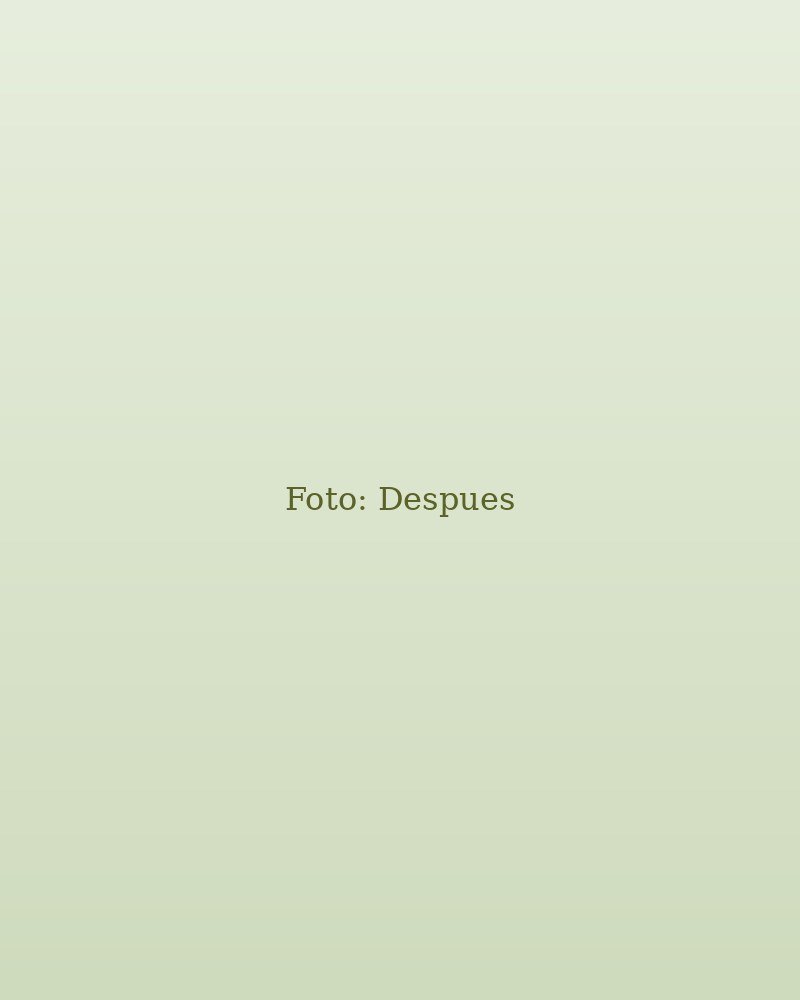 Despues - Reduccion de medidas en abdomen